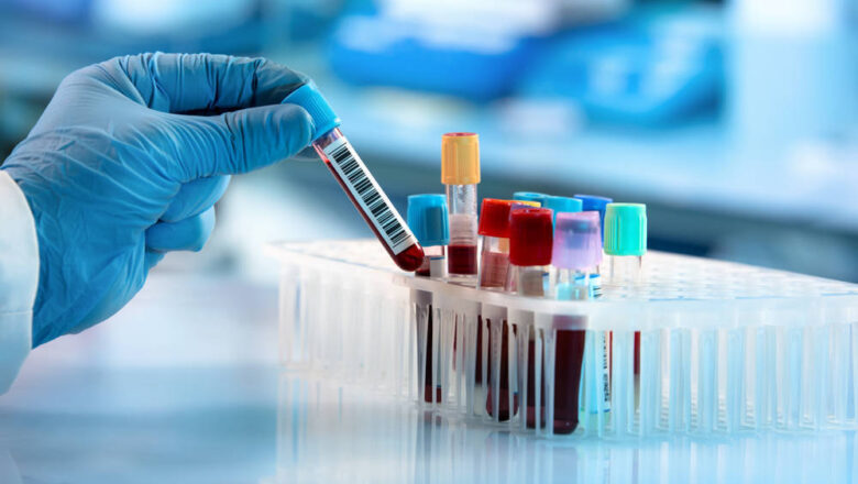doctor-hand-taking-blood-sample-tube-HbA1c-Blood-Test-tests-welzo